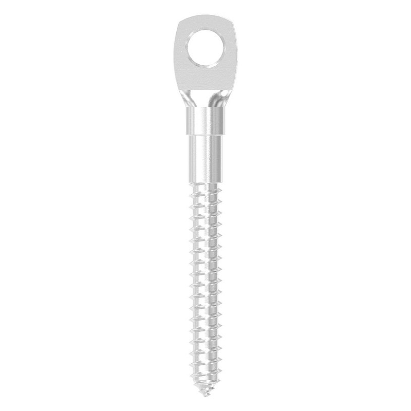 Augenschraube, mit Holzgewinde 6mm, V4A